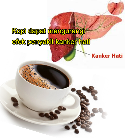 Kopi dapat mengurangi efek penyakit kanker hati